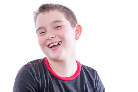 Escessive facial hair phobia Eleven year old boys nake